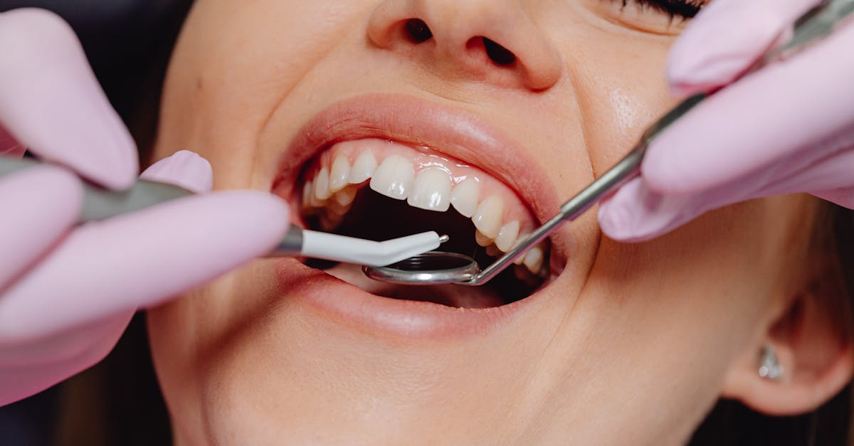 Mobile Dental Carts